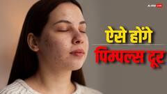 Skin Care: रात को सोने से पहले कर लें ये  छोटा सा काम...चेहरे के सारे पिंपल हो जाएंगे साफ