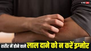 शरीर में होने वाले दाने इस बीमारी के हैं लक्षण, जानें क्यों होती है इसकी शुरुआत