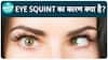 आयुर्वेद द्वारा eye squint का इलाज कैसे किया जा सकता है? | eye squint क्यों होता है? | health live