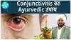 conjunctivitis के इलाज का natural तरीका | conjunctivitis उपचार | health live