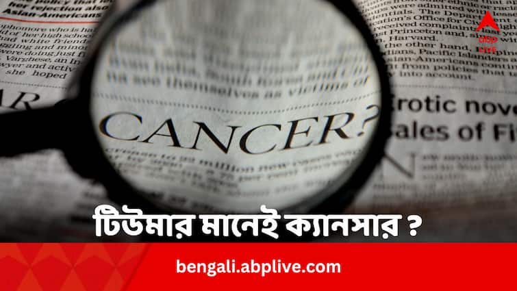 Does Painless Tumour Cause Cancer Know Signs And Treatment From Expert In Bengali abpp Health News: গায়ের নানা জায়গায় ব্যথাহীন টিউমার, ক্যানসার কি না বোঝার উপায় ?