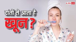Teeth Tips: क्यों सूज जाते हैं मसूड़े? जानें इसके कारण और इससे होने वाले नुकसान के बारे में
