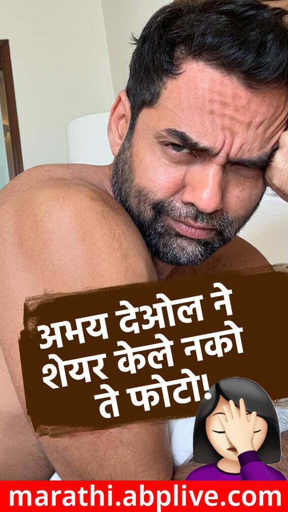 अभय देओलने शेयर केले नको त्या अवस्थेतील फोटो!