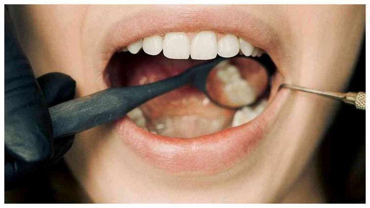 Mouth Health: Are you experiencing these symptoms in your mouth?  Do not ignore, they are signs of serious illness