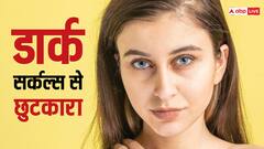 Dark Circles Tips: डार्क सर्कल्स के लिए रामबाण है ये घरेलू नुस्खे...कुछ ही दिनों में दिखने लगेगा असर