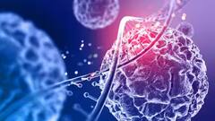 કેન્સરના દર્દીઓ માટે શરૂ કરાઇ ખાસ હેલ્પલાઇન, સલાહથી લઇને સારવાર સુધીની જાણકારી મળશે મફતમાં