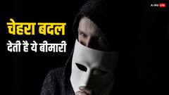 दूसरों का चेहरा दिखने लगता है शैतान जैसा...इस खास बीमारी की वजह से होता है ये