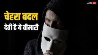 दूसरों का चेहरा दिखने लगता है शैतान जैसा...इस खास बीमारी की वजह से होता है ये