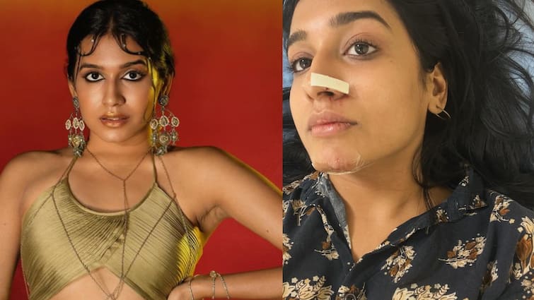 katchi sera song fame Samyuktha Viola Viswanathan faces a minor accident Actress Samyuktha: விபத்தில் சிக்கிய “கட்சி சேர” பாடல் நடிகை.. ஆறுதல் தெரிவிக்கும் ரசிகர்கள்!