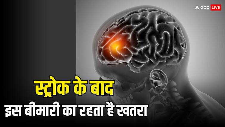 what is the biggest risk factor for post stroke depression स्ट्रोक आने के बाद 5 साल तक रहें सावधान, इस गंभीर बीमारी का रहता है सबसे ज्यादा खतरा