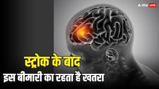स्ट्रोक आने के बाद 5 साल तक रहें सावधान, इस गंभीर बीमारी का रहता है सबसे ज्यादा खतरा