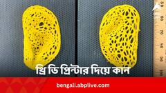 থ্রিডি প্রিন্টার দিয়ে মানুষের কান ! চিকিৎসাবিজ্ঞানের বড় সাফল্য
