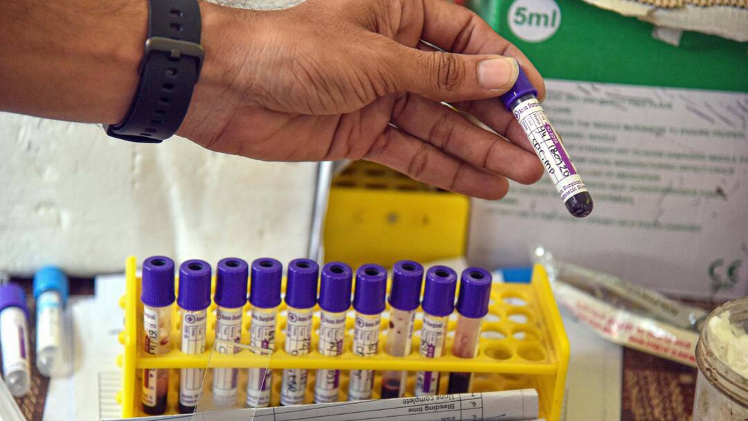 Basti Meningitis UP Brain Fever Administration CDO Issued Alert Regarding Communicable Diseases ANN बस्ती में दिमागी बुखार को लेकर अलर्ट पर प्रशासन, अधिकारियों को जारी की एडवाइजरी