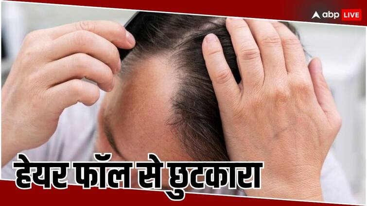 use this easy trick for hair fall and dandruff effect will be visible in few days Hair Fall: रोजाना झड़ते हैं आपके बाल, तो इस चीज को अपने बालों पर जरूर लगाएं, कुछ ही दिनों में दिखेगा असर