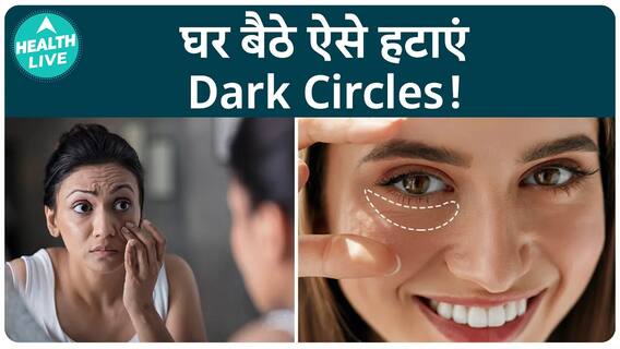 मुझे काले घेरे क्यों हैं? | घर पर डार्क सर्कल से कैसे छुटकारा पाएं? | health live