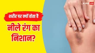 क्या आपके भी हाथ-पैर या शरीर के दूसरे हिस्से में दिखाई देते हैं चोट लगने जैसा निशान? जानें कारण