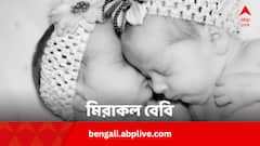 প্রিম্যাচিওর হয়েও কঠিন রোগের সঙ্গে লড়াই, সেরে উঠে মিরাকল দেখাল এই যমজ