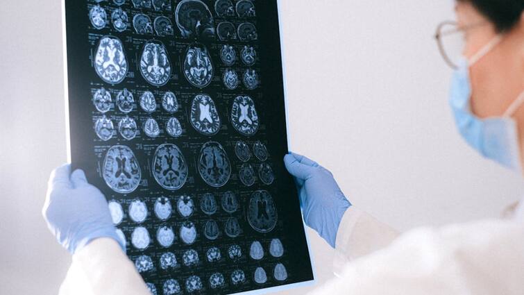oxygen reach from one corner to another in the brain Scientist researched and explained the reason for this How Oxygen Reach Brain: मस्तिष्क में एक कोने से दूसरे कोने तक कैसे पहुंचता है ऑक्सीजन, वैज्ञानिक ने शोध करके बताई इसकी वजह