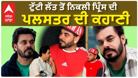 ਟੁੱਟੀ ਲੱਤ ਤੋਂ ਨਿਕਲੀ ਪ੍ਰਿੰਸ ਦੀ ਪਲਸਤਰ ਦੀ ਕਹਾਣੀ