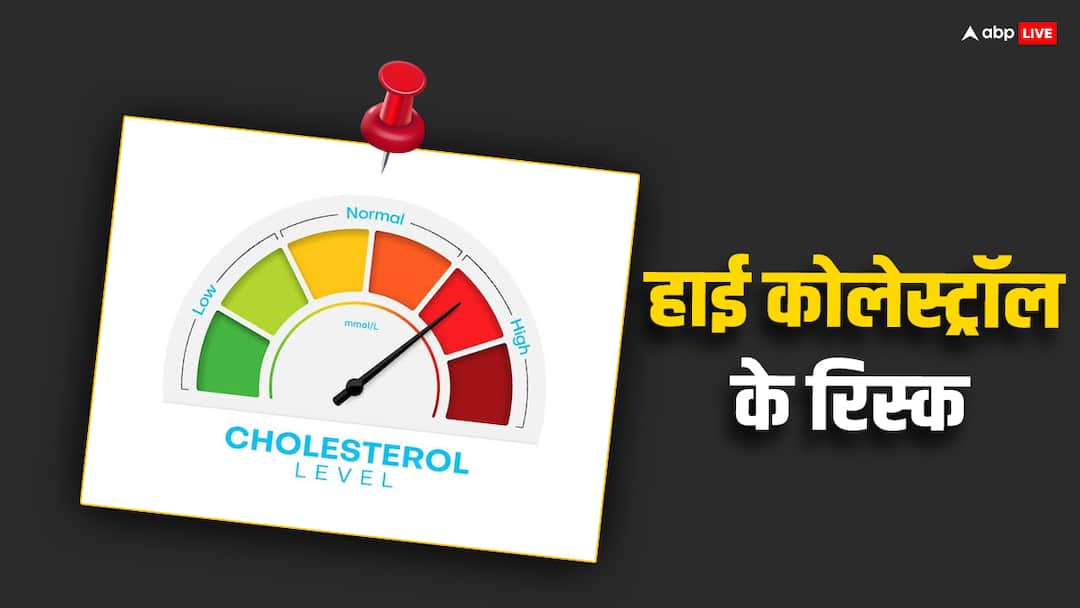 health tips high cholesterol side efects risk factors in hindi High Cholesterol: शरीर में कोलेस्ट्रॉल बढ़ना है रिस्की, दिल से लेकर दिमाग तक को नुकसान, जानें खतरे