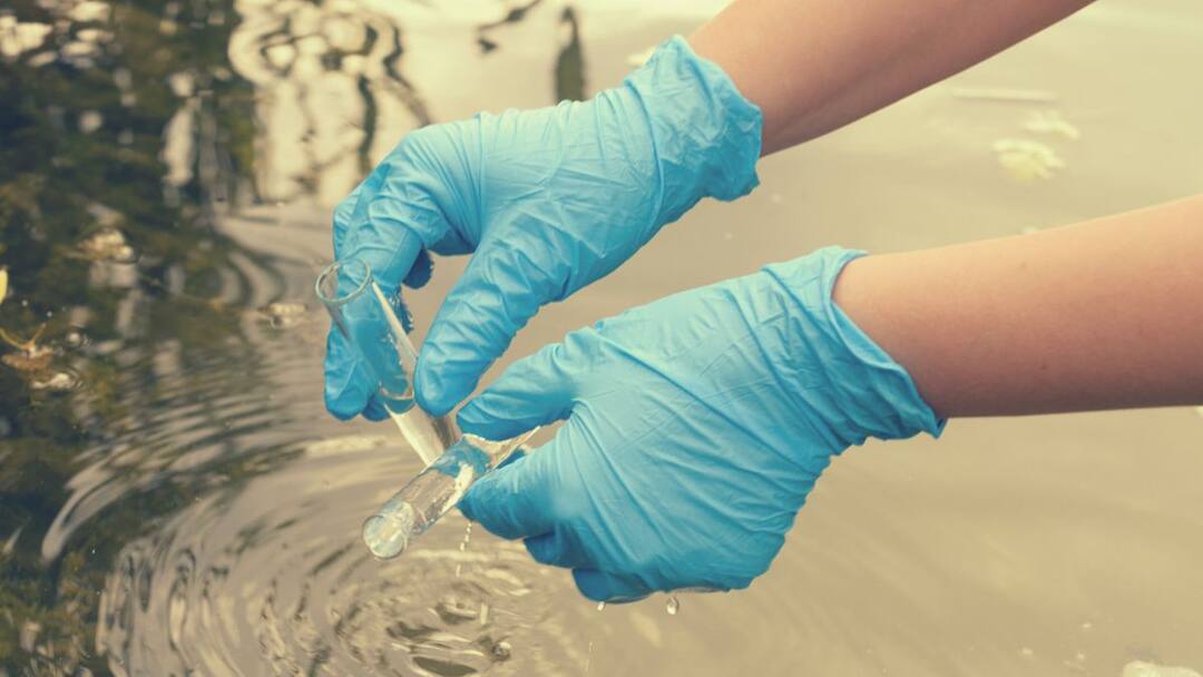 Bengaluru is hit by a massive cholera outbreak one confirmed case has been reported in the Malleshwaram area Cholera Outbreak In Bengaluru : बंगळूरमध्ये पाण्यासाठी दाहीदिशा भटकंती सुरु असतानाच आता कॉलराचा उद्रेक; तब्बल 50 टक्के रुग्ण वाढले