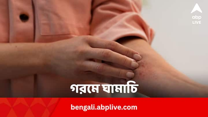 Heat Rash Remedies: গরম পড়তেই ঘামাচি হতে থাকে গায়ে। এর থেকে মুক্তি পেতে কয়েকটি ঘরোয়া উপায়ে ভরসা রাখতে পারেন।