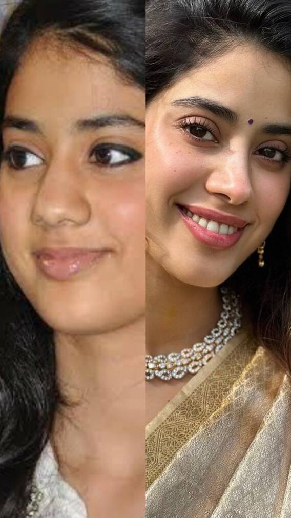 जाह्नवी कपूर की खूबसूरती का राज है फेस सर्जरी!