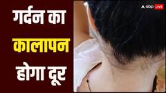 Beauty Tips: कई कोशिशों के बाद भी नहीं हो रहा गर्दन का कालापन दूर, तो आज से आजमाएं ये आसान घरेलू उपाय