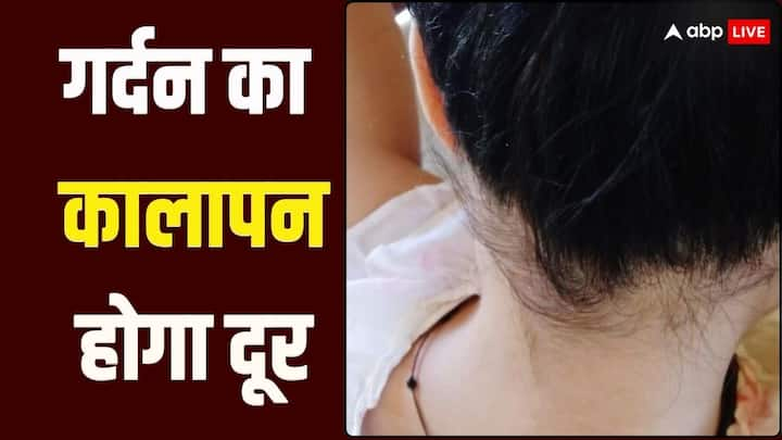 काली गर्दन सुंदरता को कम कर देती है. यह शर्मिंदा होने की वजह बन जाती है. आप इससे छुटकारा पाने के लिए कुछ घरेलू उपाय कर सकते हैं.