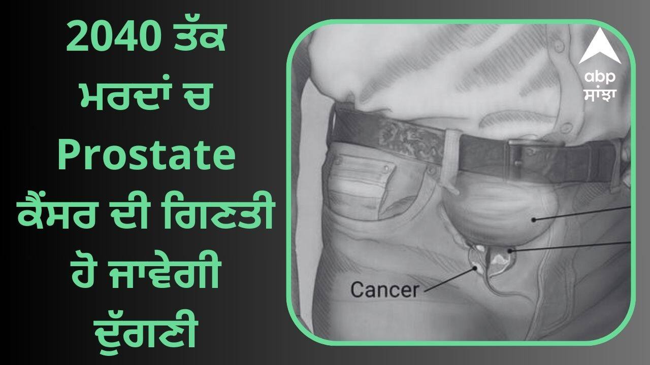 Warning ! 2040 ਤੱਕ ਮਰਦਾਂ ਚ Prostate ਕੈਂਸਰ ਦੀ ਗਿਣਤੀ ਹੋ ਜਾਵੇਗੀ ਦੁੱਗਣੀ, ਰਿਪੋਰਟ ਵਿੱਚ ਦਾਅਵਾ