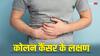 मुंह में मौजूद बैक्टीरिया बन सकता है कोलन कैंसर का कारण, स्टडी में हुआ चौंकाने वाला खुलासा