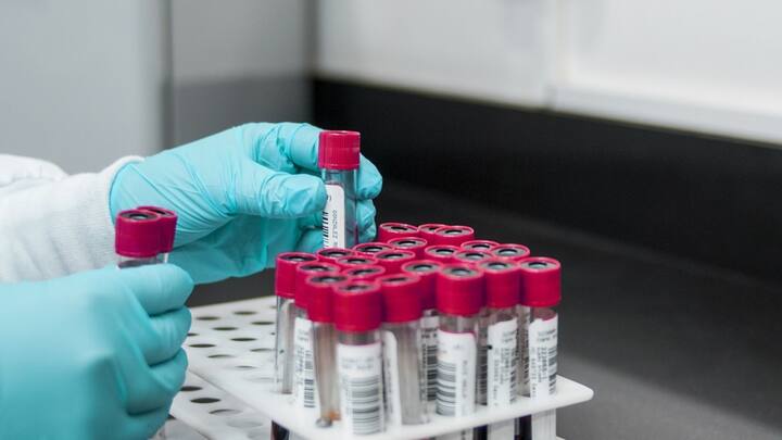 হিমোগ্লোবিনে Heme নামের একটি অণু থাকে, যার মধ্যে রয়েছে আয়রন। এই আয়রন অক্সিজেনের সংস্পর্শে এসে লাল রং ধারণ করে।