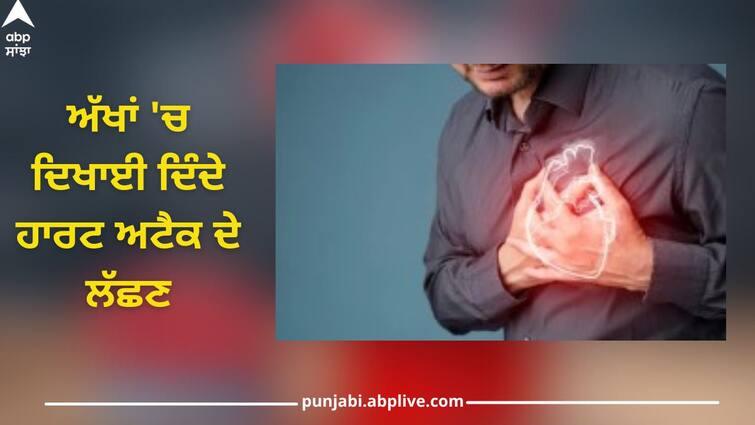 Symptoms of heart attack visible in the eyes, do not ignore even if you forget Heart Attack: ਅੱਖਾਂ 'ਚ ਦਿਖਾਈ ਦਿੰਦੇ ਹਾਰਟ ਅਟੈਕ ਦੇ ਲੱਛਣ, ਭੁੱਲ ਕੇ ਵੀ ਨਾ ਕਰੋ ਨਜ਼ਰਅੰਦਾਜ਼