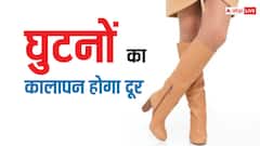 Beauty Tips: घुटनों के कालेपन से आप भी हैं परेशान, तो इन टिप्स को करें फॉलो, कुछ दिनों में दिखेगा असर