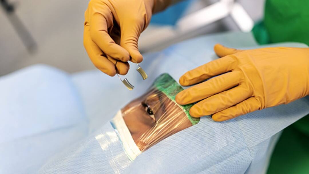 Madhya Pradesh Indore Cataract Surgery Hospital Indore Hospital's OT Sealed After 8 Patients Experience Side-Effects Following Cataract Surgery