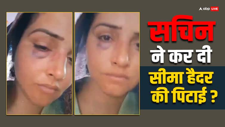 Seema Haider React on her Swollen Eye and Lip Injury Viral Video Husband Sachin Beat Seema Haider की हुई पिटाई! पाकिस्तानी मीडिया का जिक्र कर वायरल वीडियो पर अब दी सफाई