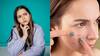 Acne Reasons : முகத்தில் எந்தெந்த இடத்தில் பருக்கள் தோன்றினால் என்னென்ன காரணம்?