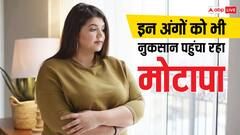 मोटापा कहीं बन न जाए सेहत का 'काल', हार्ट ही नहीं किडनी-लिवर को भी नुकसान