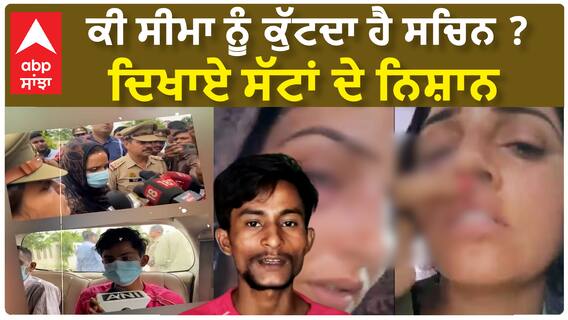 Seema Haider | ਕੀ ਸੀਮਾ ਹੈਦਰ ਨੂੰ ਕਿਸੇ ਨੇ ਕੁੱਟਿਆ ?,ਦਿਖਾਏ ਸੱਟਾਂ ਦੇ ਨਿਸ਼ਾਨ