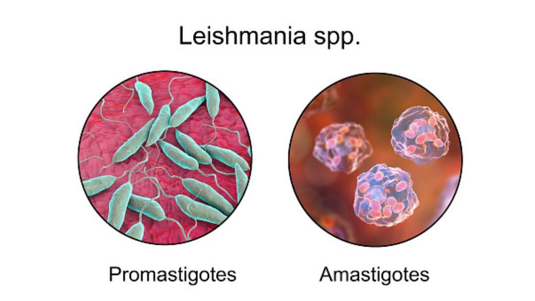 Kala Azar How Visceral Leishmaniasis And Malnutrition Are Linked Ways To Eliminate Kala Azar From India Kala-Azar: How Visceral Leishmaniasis And Malnutrition Are Linked, And Ways To Eliminate The Disease From India