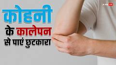 कोहनी के कालेपन को दूर करेंगे ये घरेलू नुस्खे, कुछ ही दिनों में दिखने लगेगा असर