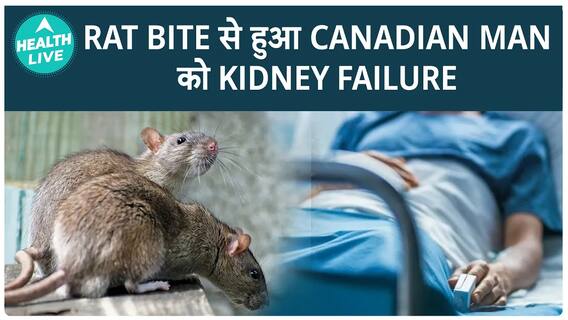 Rat Bite से बचना क्यों है जरूरी? | Rats | Health Live