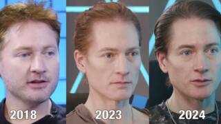 Reverse Aging:ਬੁੱਢਾ ਹੋਣ ਦੀ ਬਜਾਏ ਸਾਲ ਦਰ ਸਾਲ ਜਵਾਨ ਹੋ ਰਿਹਾ ਹੈ ਇਹ ਸ਼ਖਸ, ਕੀਤੇ ਇਹ ਦਾਅਵਾ