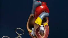 अब वॉल्व बदलने के लिए नहीं होगी किसी के भी दिल की चीर-फाड़, यह तकनीक देगी मरीजों को राहत