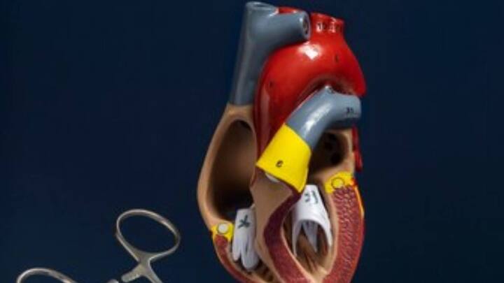 अब बिना चीर-फाड़ के वॉल्व रिप्लेसमेंट आसान हो गया है. हार्ट वॉल्व की बीमारी से पीड़ित मरीजों के लिए (TAVI) ट्रांसकैथेटर एओर्टिक वॉल्व इम्प्लांटेशन उम्मीद की एक नई किरण की तरह सामने आई है.