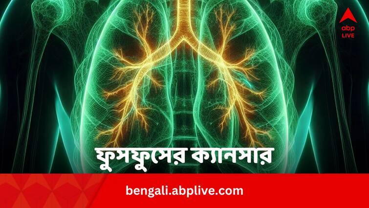 Study Suggests Colorless Odorless Radon Gas Is Responsible For Non-smoking Lung Cancer in Bengali Lung Cancer: ধূমপান না করলেও কেন ফুসফুস ক্যানসার ? জানা গেল আসল কারণ
