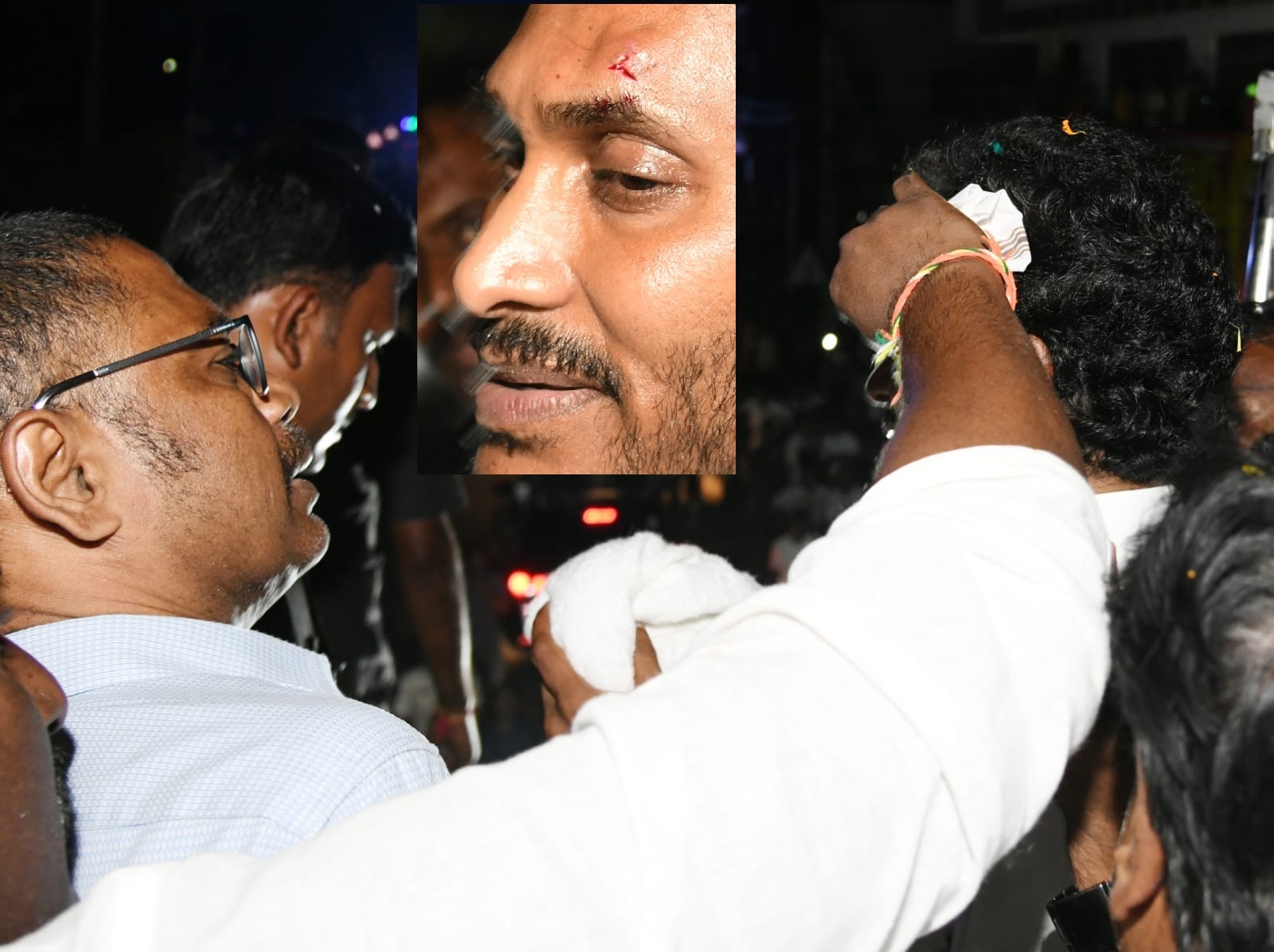 YS Jagan Injured: ఏపీ సీఎం జగన్ పై రాయితో దాడి, ఎడమ కంటిపైన గాయం - చంద్రబాబు చేయించారని వైసీపీ మండిపాటు