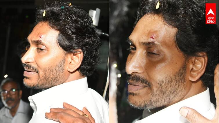 stone attack against AP CM YS Jagan Mohan Reddy YS Jagan Injured: ఏపీ సీఎం జగన్ పై రాయితో దాడి, ఎడమ కంటిపైన గాయం - చంద్రబాబు చేయించారని వైసీపీ మండిపాటు