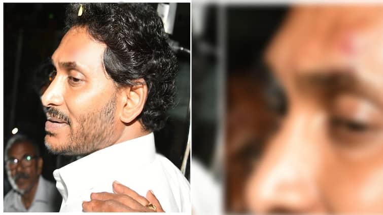 Andhra preadesh CM and YSRCP chief YS Jagna suffer injuries and stone attack during his bus yatra Jagan Mohan Reddy: பரபரப்பு! ஜெகன்மோகன் ரெட்டி மீது கல்வீச்சு - ரத்தம் சிந்திய ஆந்திர முதலமைச்சர்