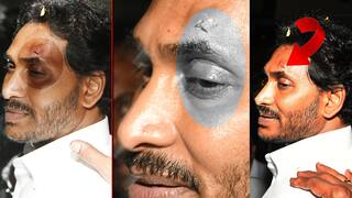 Jagan Mohan Reddy: આંધ્ર પ્રદેશના સીએમ જગન મોહન રેડ્ડીના રોડ શો પર પથ્થરમારો,માથામાં થઈ ઈજા